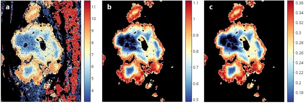 Exported data from Mineralogic is designed to provide all your geochemical data with maximum flexibility. Here we see element heatmaps imported into XMapTools. a) Quantitative EDS analysis from Mineralogic imported directly into XMapTools (garnet data from figure 2b). XMapTools enables median filtering and conversion of EDS data with many useful functions including b) cation per formula unit (cpfu) for Ca in X site, and c) end member grossular (Ca component) calculation.