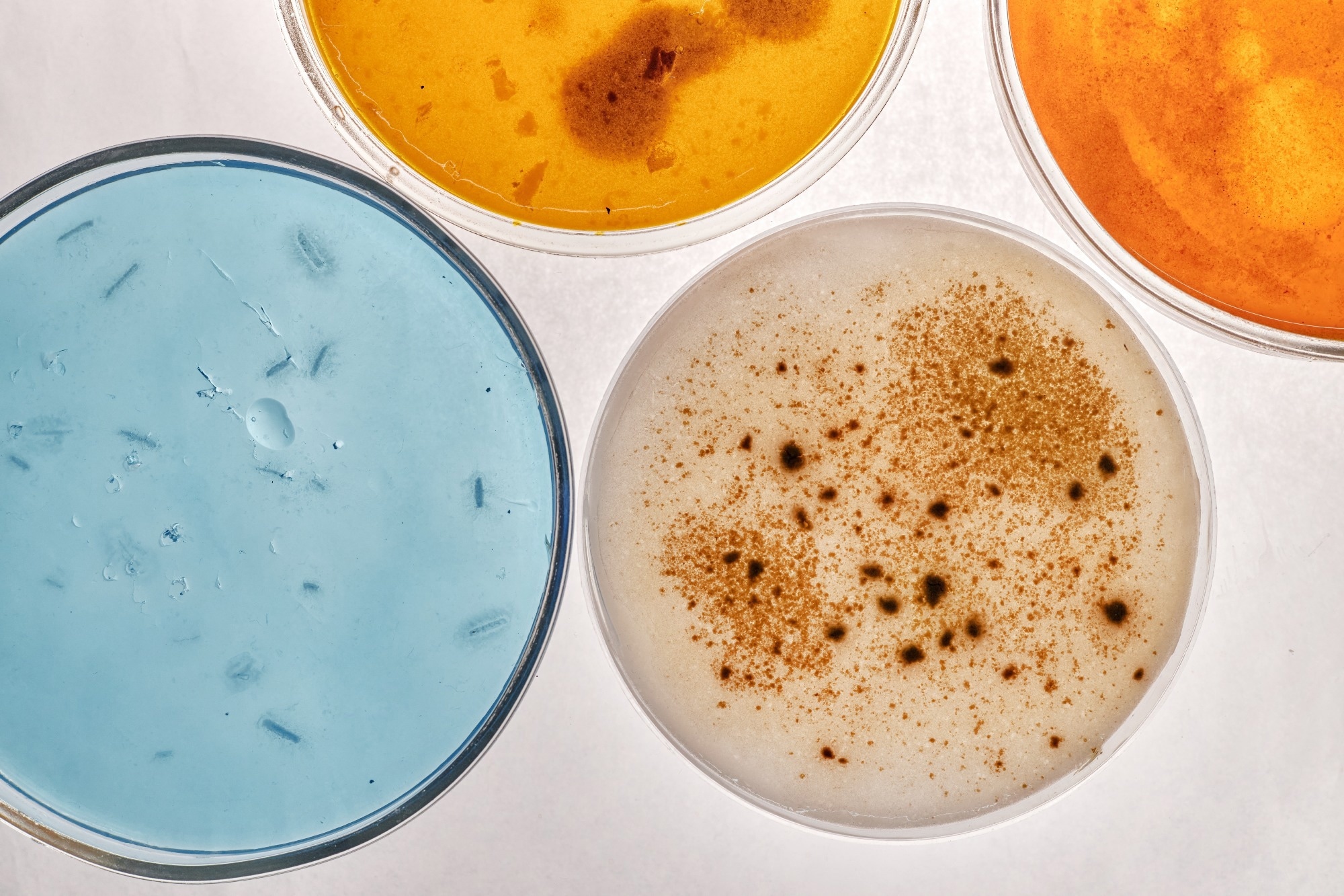 Overhead view showing four petri dishes containing different colored agar mediums with visible bacterial or fungal colonies growing on surfaces, arranged on background