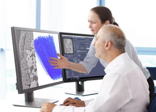 ZEISS OptiRecon: Implementation of Iterative Reconstruction