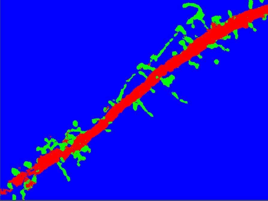 Segmentation with ZEN Intellesis results in a clear separation of spines (green) from dendrite (red) and background (blue).