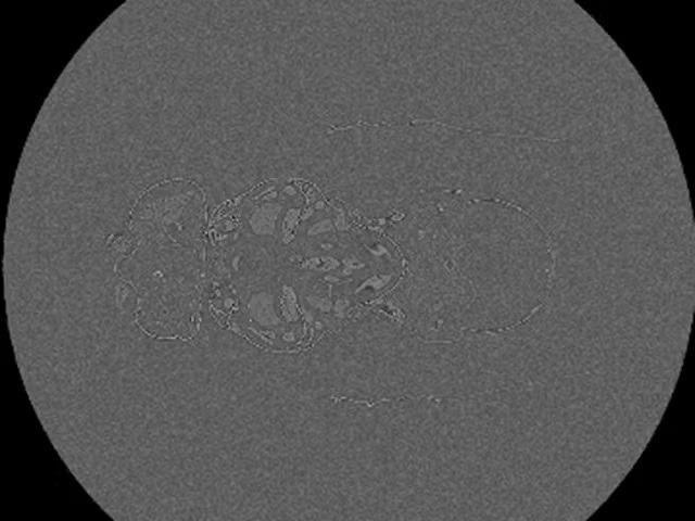 X-Ray micrograph of a Drosophila melanogaster. 1400 slide z-stack of the whole fruit fly acquired with ZEISS 520 Versa.