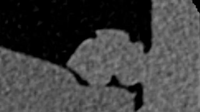 ZEISS OptiRecon: Implementation of Iterative Reconstruction