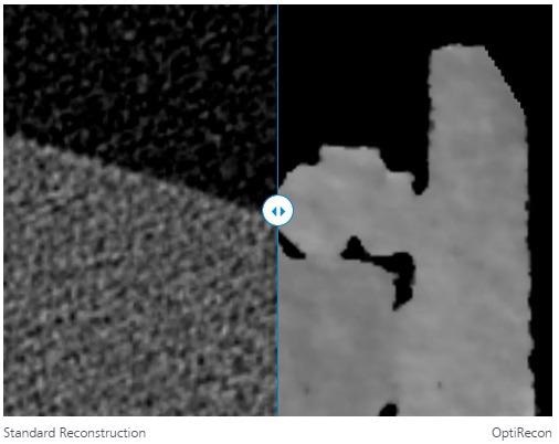ZEISS OptiRecon: Implementation of Iterative Reconstruction