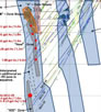 Eloro Resources to Re-Start Drilling at Val-d'Or Gold Mining Camp